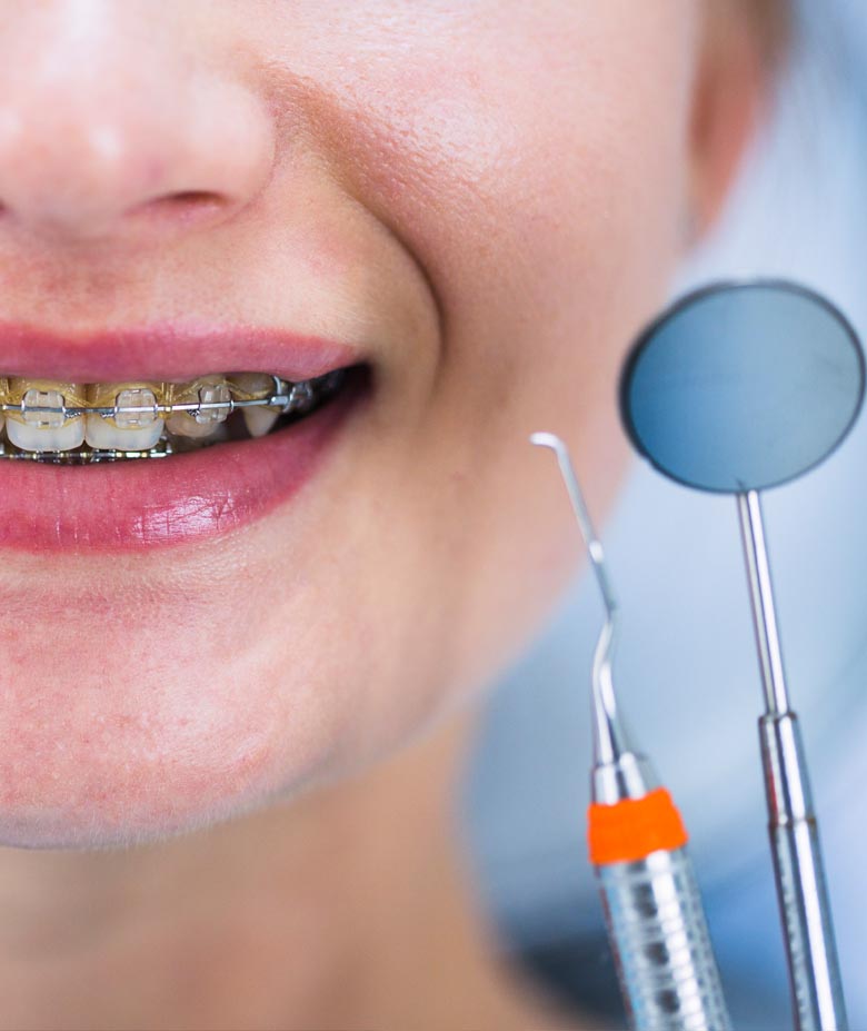 oblasti rada ortodoncija stomatoloski centar nis